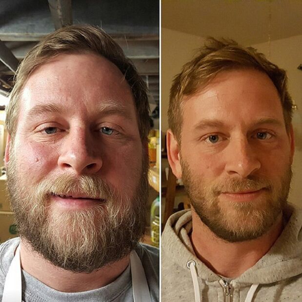 izgled osobe prije i nakon odustajanja od alkohola